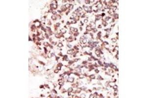 Image no. 2 for anti-Proto-Oncogene Pim-2 (Serine Threonine Kinase) (PIM2) (C-Term) antibody (ABIN360329) (PIM2 antibody  (C-Term))