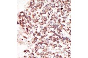 Image no. 2 for anti-Proto-Oncogene Pim-2 (Serine Threonine Kinase) (PIM2) (C-Term) antibody (ABIN360329)