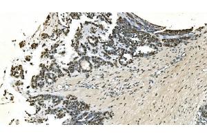 IHC analysis of LSM7 using anti-LSM7 antibody (ABIN7598937). (LSM7 antibody  (AA 1-103))