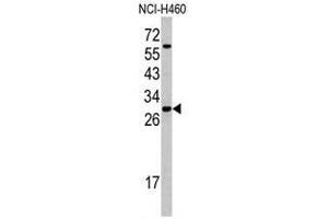 Western blot analysis of SFRS5 antibody (Center Y85) in NCI-H460 cell line lysates (35ug/lane). (SRSF5 antibody  (Middle Region))