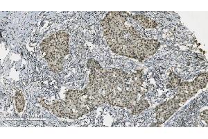 IHC analysis of PARP using anti-PARP antibody (ABIN7602278). (PARP1 antibody  (AA 670-858))