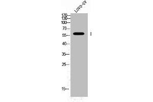 Western Blot analysis of LOVO+UV cells using Phospho-Fyn (Y530) Polyclonal Antibody (FYN antibody  (pTyr530))