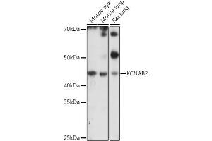 Western blot analysis of extracts of various cell lines, using KCN antibody (ABIN7269481) at 1:1000 dilution. (KCNAB2 antibody  (AA 1-40))