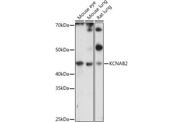 KCNAB2 抗体  (AA 1-40)