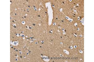 Immunohistochemistry of Human brain  using PPP3CA Polyclonal Antibody at dilution of 1:40 (PPP3CA antibody)