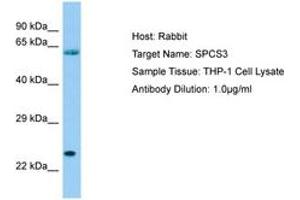 Image no. 1 for anti-Signal Peptidase Complex Subunit 3 Homolog (SPCS3) (AA 51-100) antibody (ABIN6750074) (SPCS3 antibody  (AA 51-100))