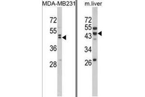 (LEFT) Western blot analysis of WNT10B Antibody (Center) in MDA-MB231 cell line lysates (35ug/lane).