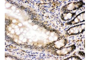 nmt55/p54nrb was detected in paraffin-embedded sections of rat intestine tissues using rabbit anti- nmt55/p54nrb Antigen Affinity purified polyclonal antibody at 1 μg/mL. (NONO antibody  (N-Term))
