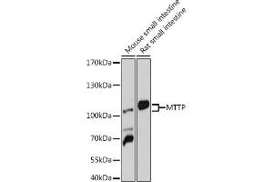 Western blot analysis of extracts of various cell lines, using MTTP antibody (ABIN6129583, ABIN6144184, ABIN6144185 and ABIN6218239) at 1:1000 dilution. (MTTP antibody  (AA 1-130))