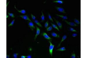 Immunofluorescent analysis of Hela cells using ABIN7170199 at dilution of 1:100 and Alexa Fluor 488-congugated AffiniPure Goat Anti-Rabbit IgG(H+L) (SLC25A46 antibody  (AA 1-102))