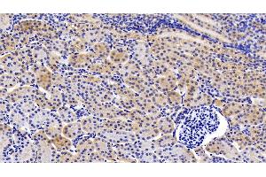 Detection of gp130 in Porcine Kidney Tissue using Polyclonal Antibody to Glycoprotein 130 (gp130) (CD130/gp130 antibody  (AA 392-566))