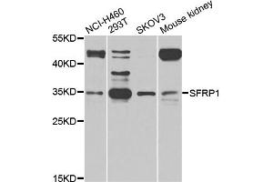 Western blot analysis of extracts of various cell lines, using SFRP1 antibody (ABIN5975810) at 1/1000 dilution. (SFRP1 antibody)