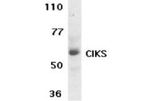 Image no. 1 for anti-TRAF3 Interacting Protein 2 (TRAF3IP2) (AA 554-568) antibody (ABIN205307) (TRAF3IP2 antibody  (AA 554-568))