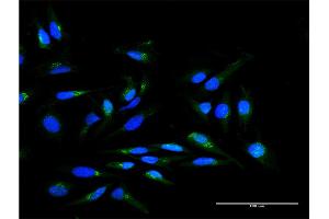 Immunofluorescence of purified MaxPab antibody to SCYL1BP1 on HeLa cell. (GORAB antibody  (AA 1-246))