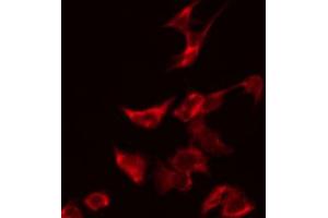 ABIN6274129 staining HeLa by IF/ICC. (TUSC2 antibody  (Internal Region))