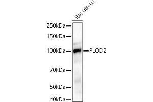 Western blot analysis of extracts of Rat uterus, using PLOD2/LH2 antibody (ABIN6132888, ABIN6145788, ABIN6145790 and ABIN6222693) at 1:1000 dilution. (PLOD2 antibody  (AA 470-650))