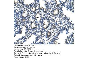 Rabbit Anti-PCBP2 Antibody  Paraffin Embedded Tissue: Human Lung Cellular Data: Alveolar cells Antibody Concentration: 4. (PCBP2 antibody  (Middle Region))