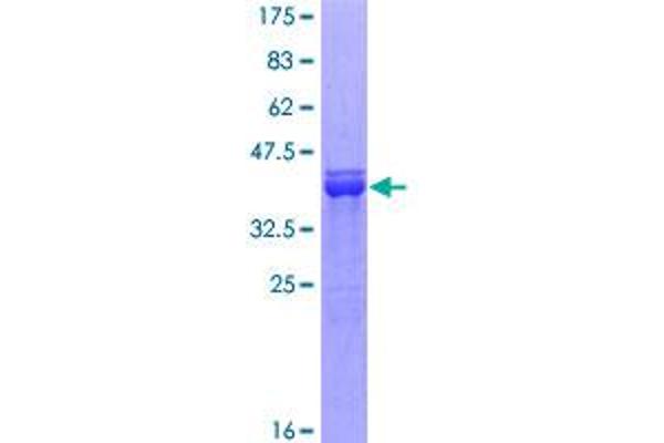 SOX9 Protein (AA 400-509) (GST tag)