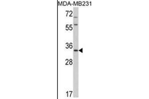 Western blot analysis of HPGD Antibody (C-term) in MDA-MB231 cell line lysates (35ug/lane). (HPGD antibody  (C-Term))