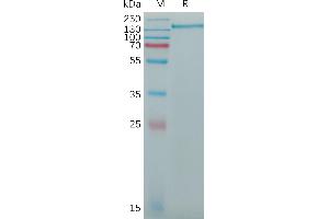 Human CD163 Protein, His Tag on SDS-PAGE under reducing condition.