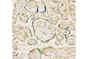 Immunohistochemistry of paraffin embedded human placenta using Efnb3 (ABIN7073845) at dilution of 1: 600 (250x lens)