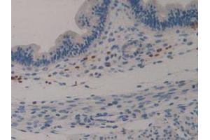 IHC-P analysis of Mouse Uterus Tissue, with DAB staining. (Klotho antibody  (AA 516-955))