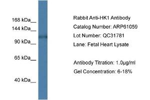 Western Blotting (WB) image for anti-Hexokinase 1 (HK1) (N-Term) antibody (ABIN2788663) (Hexokinase 1 antibody  (N-Term))