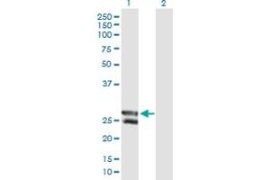 Western Blot analysis of C12orf72 expression in transfected 293T cell line by C12orf72 MaxPab polyclonal antibody.