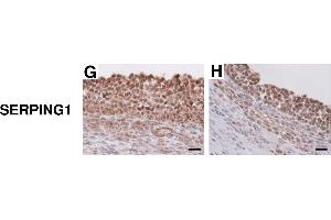 Protein localization of SERPINA5, SERPINB6, SERPINF2 and SERPING1 in E2-active and E2-inactive follicles. (SERPING1 antibody  (Center))