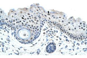SF3B1 antibody was used for immunohistochemistry at a concentration of 4-8 ug/ml to stain Epidermal cells (arrows) in Human Skin. (SF3B1 antibody  (N-Term))