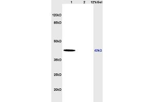 Lane 1: human colon carcinoma lysates Lane 2: rat brain lysates probed with Anti Midkine Polyclonal Antibody, Unconjugated (ABIN735338) at 1:200 in 4 °C. (Midkine antibody)