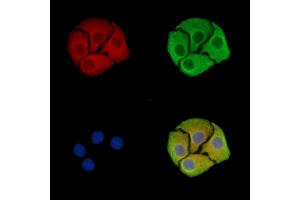 anti-SPOC Domain Containing 1 (SPOCD1) antibody