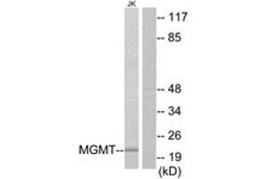 Western blot analysis of extracts from Jurkat cells, using MGMT Antibody. (MGMT antibody  (AA 1-50))