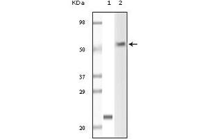 Western Blotting (WB) image for anti-Lymphocyte-Specific Protein tyrosine Kinase (LCK) (truncated) antibody (ABIN2464076) (LCK antibody  (truncated))