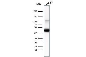 Western Blot Analysis of human HT29 cell lysate usingCK20 Mouse Monoclonal Antibody (KRT20/3145). (KRT20 antibody  (AA 196-323))