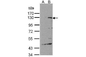 WB Image Western Blot analysis of SIPA1 expression in transfected 293T cell line by SIPA1 polyclonal antibody. (SIPA1 antibody  (C-Term))