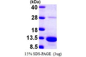 SDS-PAGE (SDS) image for S100 Calcium Binding Protein A5 (S100A5) (AA 1-92) protein (His tag) (ABIN667887) (S100A5 Protein (AA 1-92) (His tag))