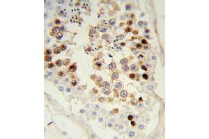 Formalin-fixed and paraffin-embedded human testis tissue reacted with SNAI Antibody, which was peroxidase-conjugated to the secondary antibody, followed by DAB staining. (SNAI antibody)