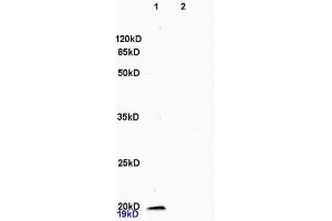 SDS-PAGE (SDS) image for anti-Colony Stimulating Factor 3 (Granulocyte) (CSF3) (AA 155-198) antibody (ABIN736521)