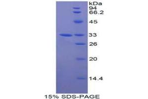 SDS-PAGE analysis of Human GAB3 Protein. (GAB3 Protein)