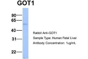 Host:  Rabbit  Target Name:  GOT1  Sample Type:  Human Fetal Liver  Antibody Dilution:  1. (GOT1 antibody  (N-Term))