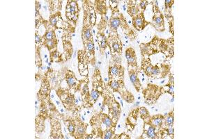 Immunohistochemistry of paraffin-embedded human liver using ACADS / SCAD Rabbit mAb (ABIN7265419) at dilution of 1:50 (40x lens).