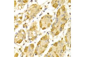 Immunohistochemistry of paraffin-embedded Human gastric using HSD17B2 antibody at dilution of 1:100 (x400 lens).
