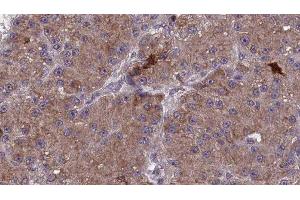 ABIN6277856 at 1/100 staining Human liver cancer tissue by IHC-P. (MAG antibody  (C-Term))