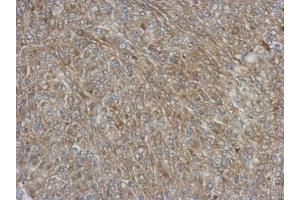 IHC-P Image Immunohistochemical analysis of paraffin-embedded Hela xenograft, using NCF1, antibody at 1:500 dilution. (NCF1 antibody)