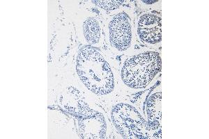 (ABIN185101) Negative Control showing staining of paraffin embedded Human Tonsil, with no primary antibody. (CSTB antibody  (C-Term))
