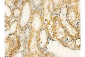 ABIN6259615 and ABIN6275472 at 1/100 staining human normal kidney tissue by IHC-P. (WTH3DI antibody  (Internal Region))