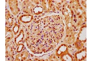 IHC image of ABIN7150243 diluted at 1:400 and staining in paraffin-embedded human kidney tissue performed on a Leica BondTM system. (POLE4 antibody  (AA 8-117))