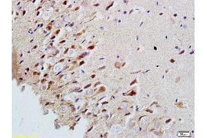 Formalin-fixed and paraffin embedded rat brain labeled with Rabbit Anti-MAP2/MAP-2a. (MAP2 antibody  (AA 1-120))