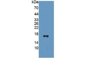 WB of Protein Standard: different control antibodies against Highly purified E. (CAP2 ELISA Kit)